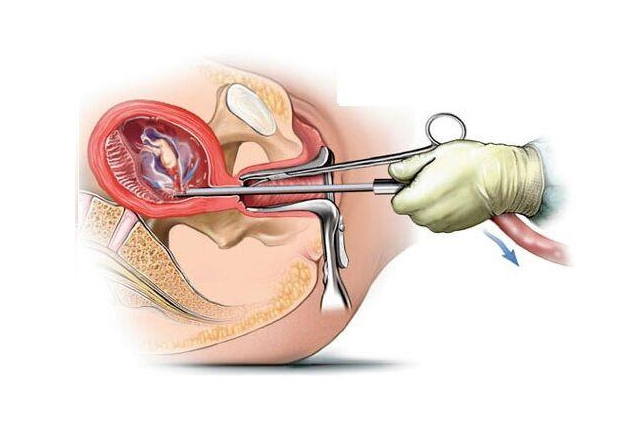 ��ԭ�����֏�(f��),�o(w��)ʹ�����z��,�o(w��)ʹ�����ί�,