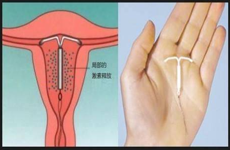 ��ԭ�ϭh(hu��n)ȡ�h(hu��n)ԭ��,�ϭh(hu��n)ȡ�h(hu��n)�z��,�ϭh(hu��n)ȡ�h(hu��n)�ί�,