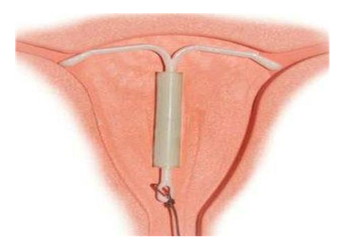 ��ԭ��(ji��)���h(hu��n)ע�����,��(ji��)���h(hu��n)����,�ϭh(hu��n)�l��,