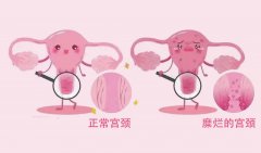 �ί��m�i�Ӡ��ķ�������Щ��